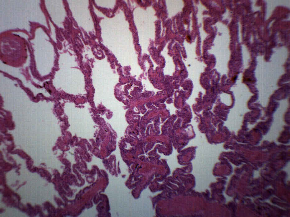 Frog Lung Section - Prepared Microscope Slide - 75x25mm