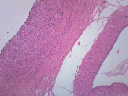 Human Artery & Vein - Prepared Microscope Slide - 75x25mm