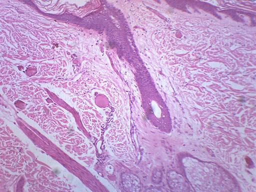 Hairy Skin, Section - Prepared Microscope Slide - 75x25mm