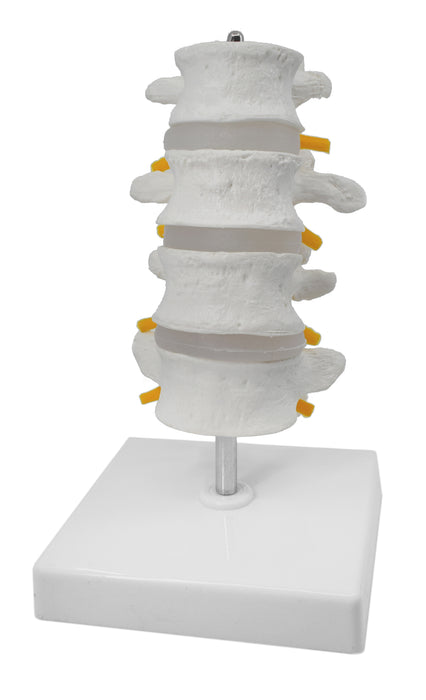 4 Lumbar Vertebrae with Nerve Branches Model, 7.25" tall on Base
