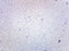 Staphylococcus Aureus - Gram Pos. - Prepared Microscope Slide - 75x25mm