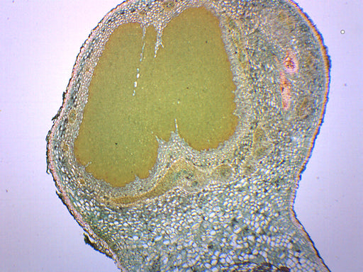 Legume Root Nodule - Prepared Microscope Slide - 75x25mm
