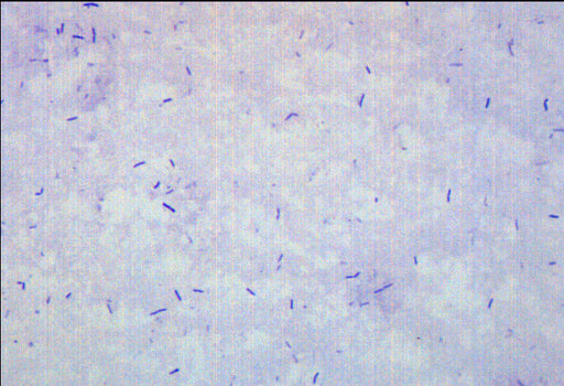 Bacillus Smear, Gram-Positive - Prepared Microscope Slide - 75x25mm