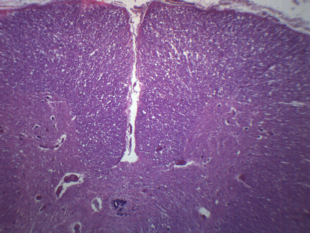 Cervical Spinal Cord, Human - Cross Section - Prepared Microscope Slid —  Eisco Labs, image size:1024x768