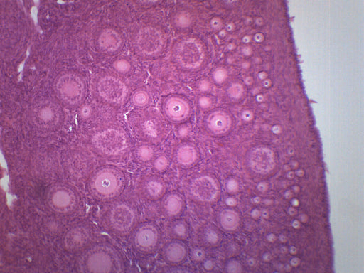 Immature Ovary - Prepared Microscope Slide - 75x25mm