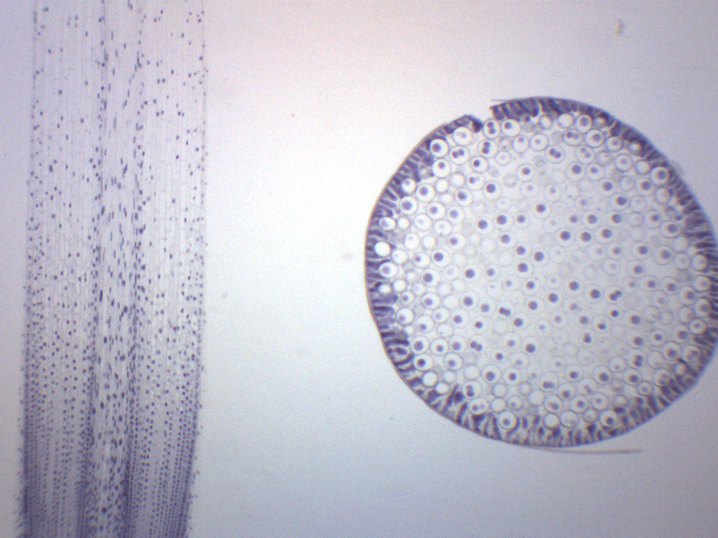 Ascaris & Onion Mitosis - Prepared Microscope Slide - 75x25mm