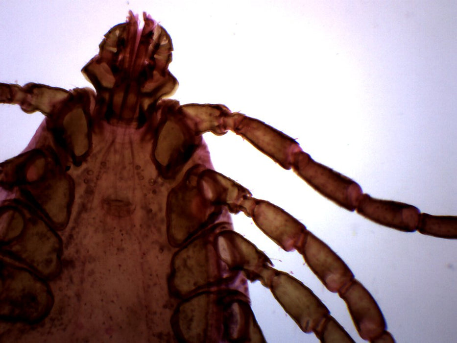 Histology Tick - Wholemount - Prepared Microscope Slide - 75x25mm