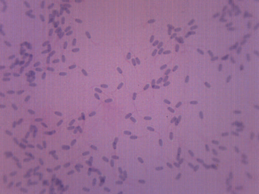 Sperm Smear - Prepared Microscope Slide - 75x25mm