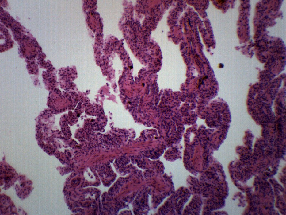 Frog Lung Section - Prepared Microscope Slide - 75x25mm