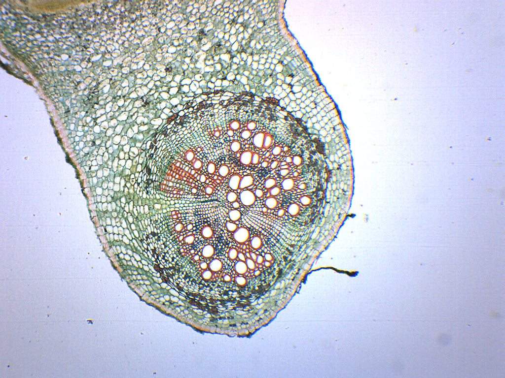 Legume Root Nodule - Prepared Microscope Slide - 75x25mm — Eisco Labs