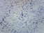 Mycobacterium Tuberculosis - Gram Pos. - Prepared Microscope Slide - 75x25mm