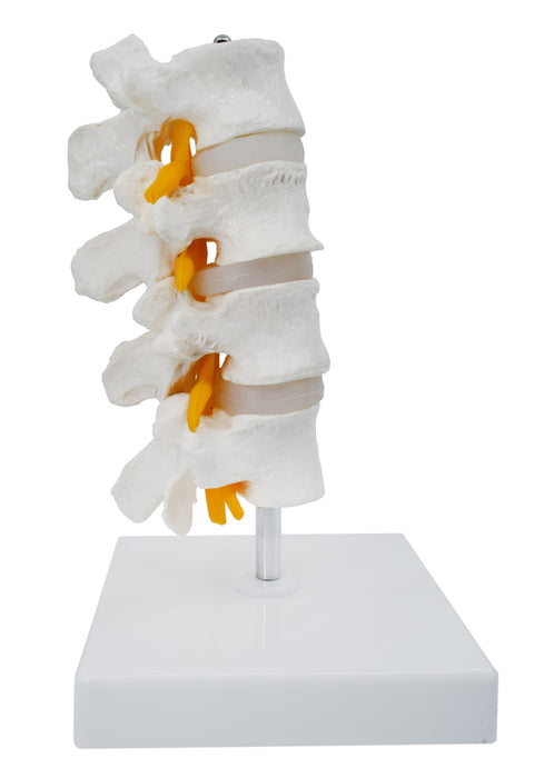 4 Lumbar Vertebrae with Nerve Branches Model, 7.25" tall on Base