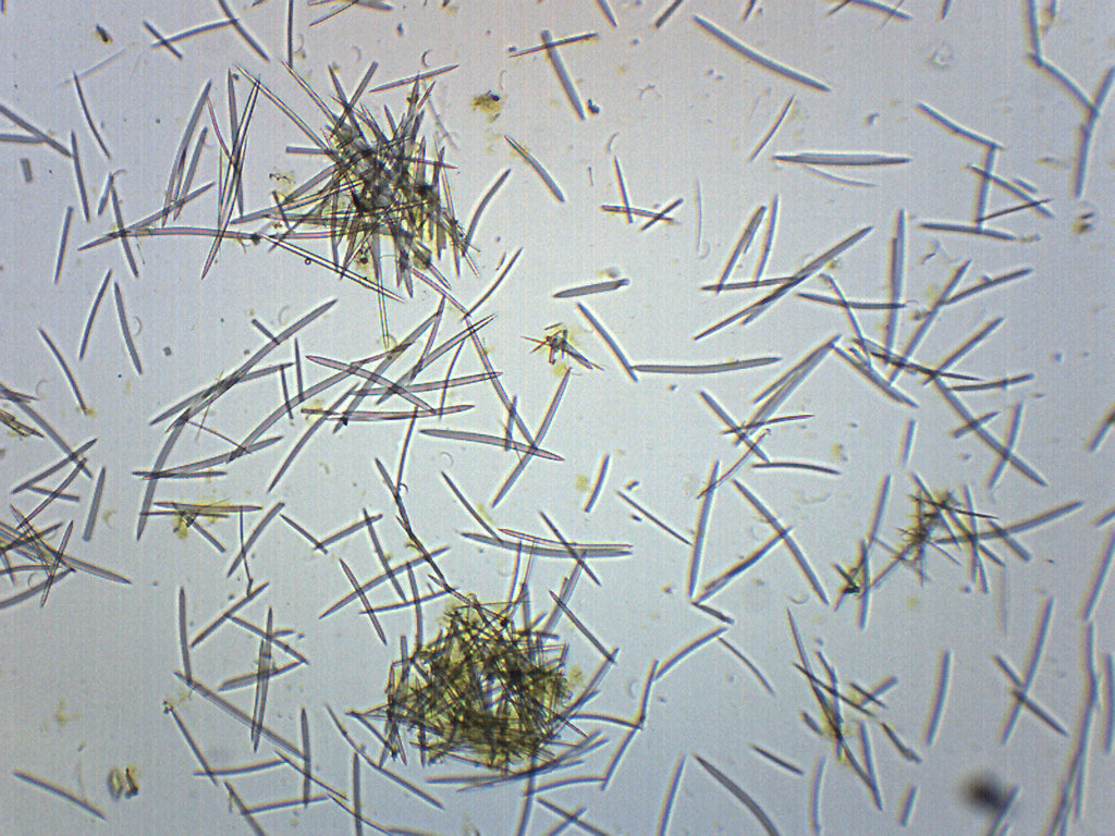Spickules Spicules