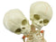 Infant Fetus Skeleton Model, Mini Size - Twin, Conjoined Skull - Rod Mounted - Incredible Detail for Anatomical Study - Eisco Labs