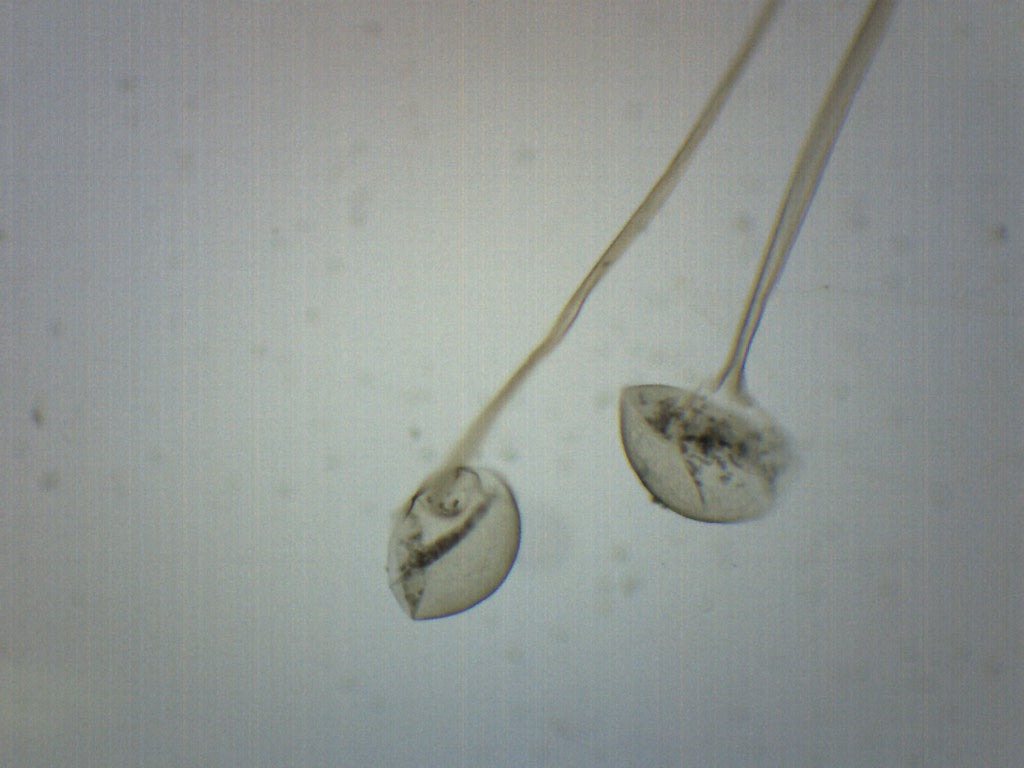 Rhizopus, Asexual Reproduction - Prepared Microscope Slide - 75x25mm