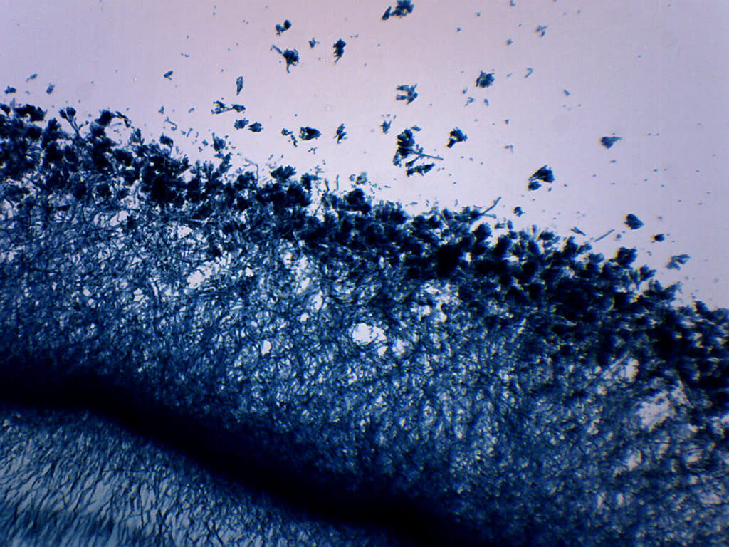 Fungi Molds, 3 Types - Wholemount - Prepared Microscope Slide - 75x25mm