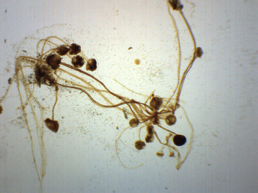 Rhizopus Sporangia - Wholemount - Prepared Microscope Slide - 75x25mm