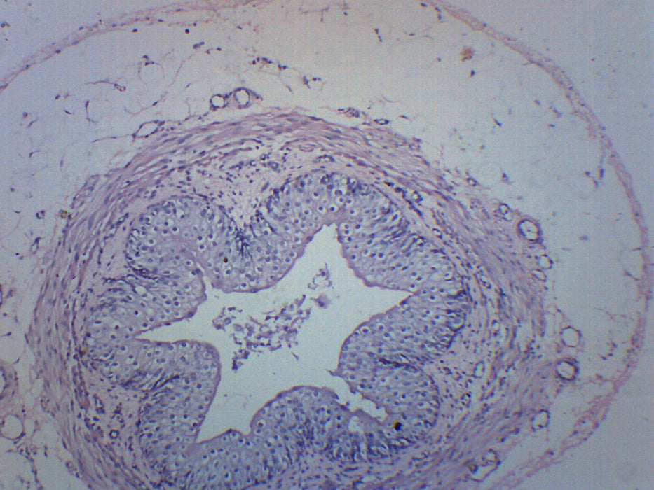 Human Ureter - Prepared Microscope Slide - 75x25mm