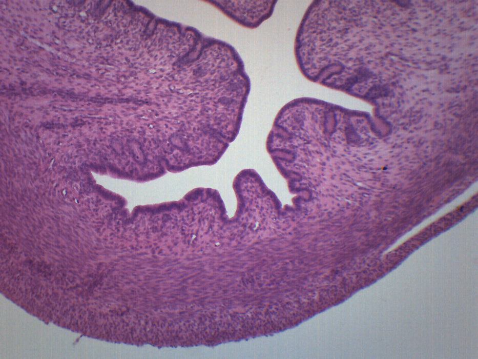 Female Uterus - Prepared Microscope Slide - 75x25mm