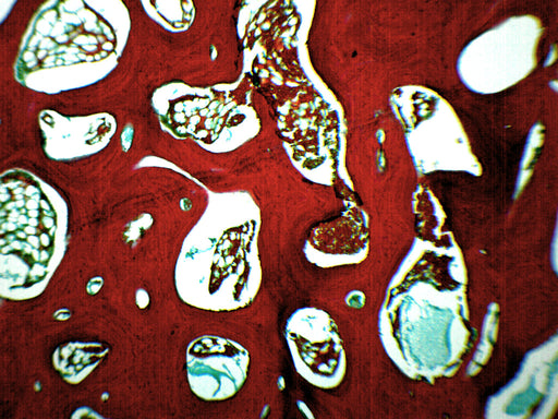 Spongy Bone Section (Mammal) - Prepared Microscope Slide - 75x25mm
