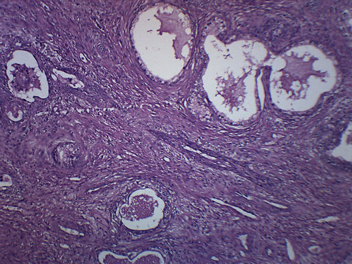 Human Prostate Section - Prepared Microscope Slide - 75x25mm