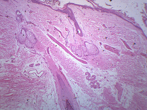 Hairy Skin, Section - Prepared Microscope Slide - 75x25mm