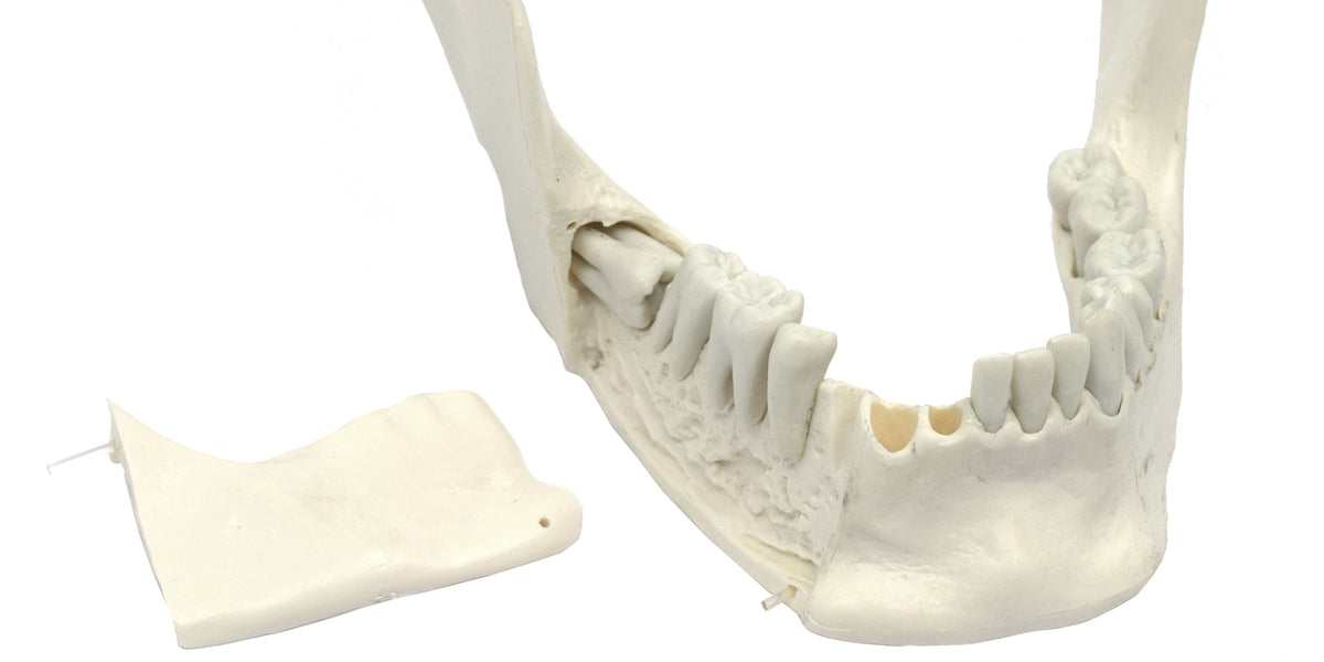 Lower Jaw Model, 16 Extractable Teeth - Anatomically Accurate
