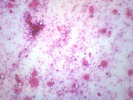 Human Sperm Smear - Prepared Microscope Slide - 75x25mm