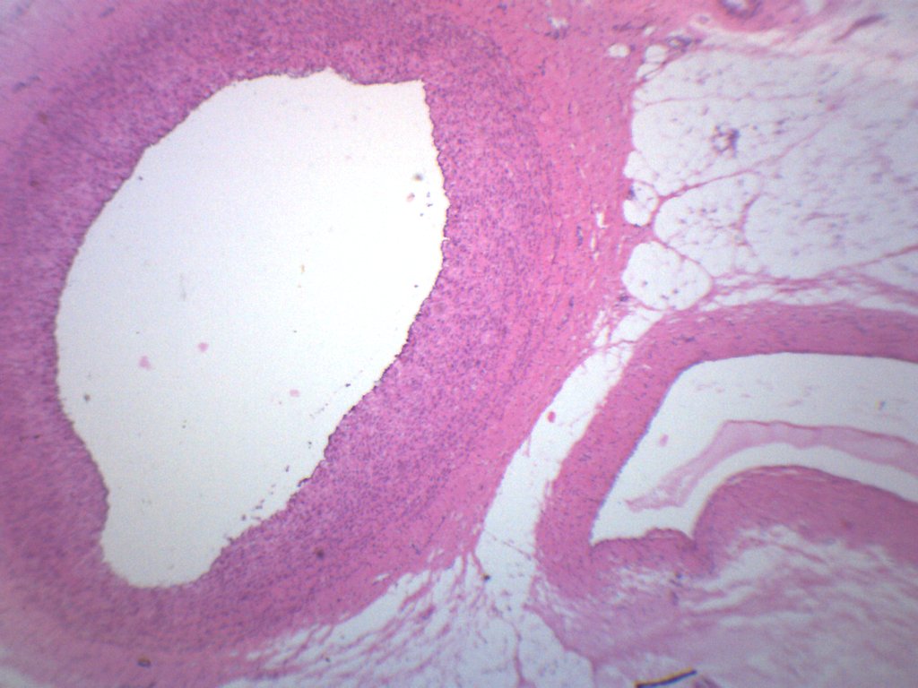 Human Artery & Vein - Prepared Microscope Slide - 75x25mm